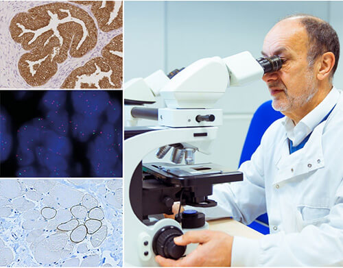 IHC Primary Antibodies IHC Primary Antibodies