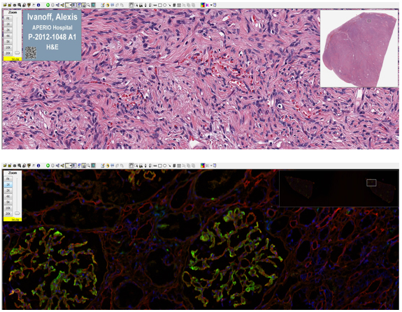 Aperio ImageScope Aperio ImageScope